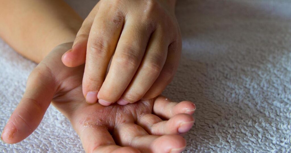 Here's What It Really Means When Your Left Hand Itches