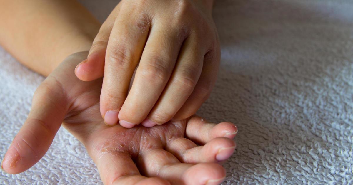 Having an itching left hand - and what it means on your money 2025 Here's What It Really Means When Your Left Hand Itches